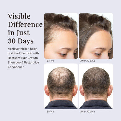 hair growth roll serum
